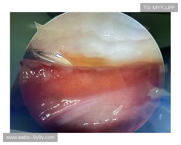 运动医学进步助力球员伤病恢复加速，缩短恢复周期